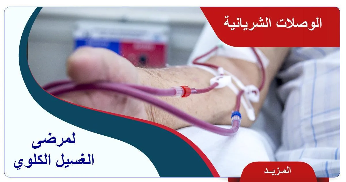 تعليمات للحفاظ على الوصلات الشريانية الوريدية لمرضى الغسيل الكلوي